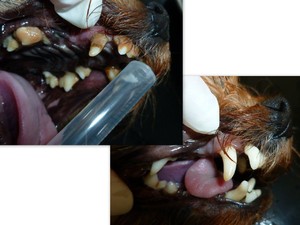 Odstránenie zubného kameňa ultrazvukom